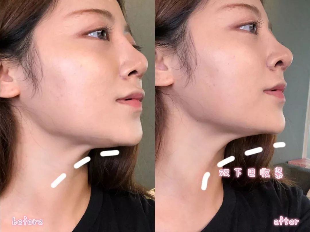 陈乔恩现在怎么样了,陈乔恩最近的新消息