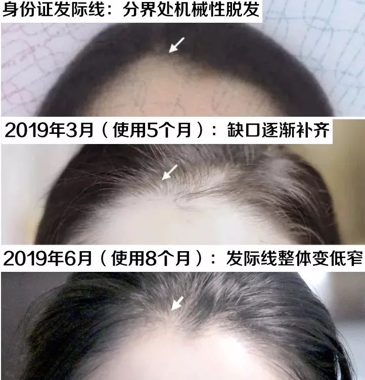 想要「换发型等于换头」？看这简单3步就可以