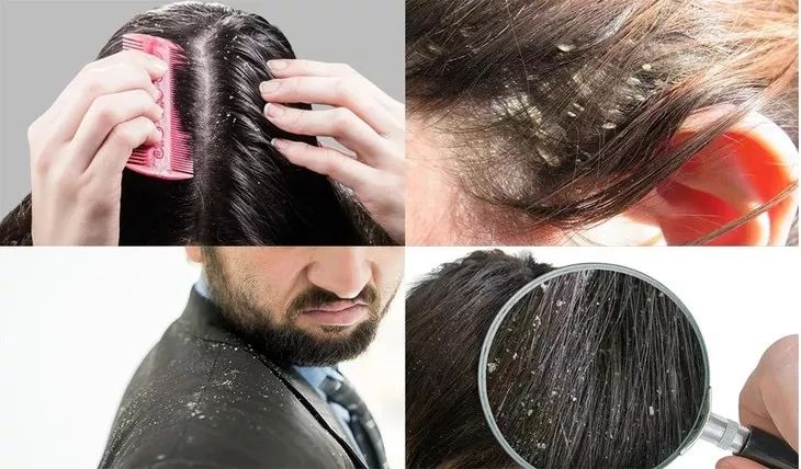 你的头发一天一次还长吗,你的头发那么长不会掉下来吗