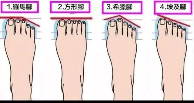 罗马脚希腊脚埃及脚命运,罗马脚希腊脚埃及脚各是什么特点