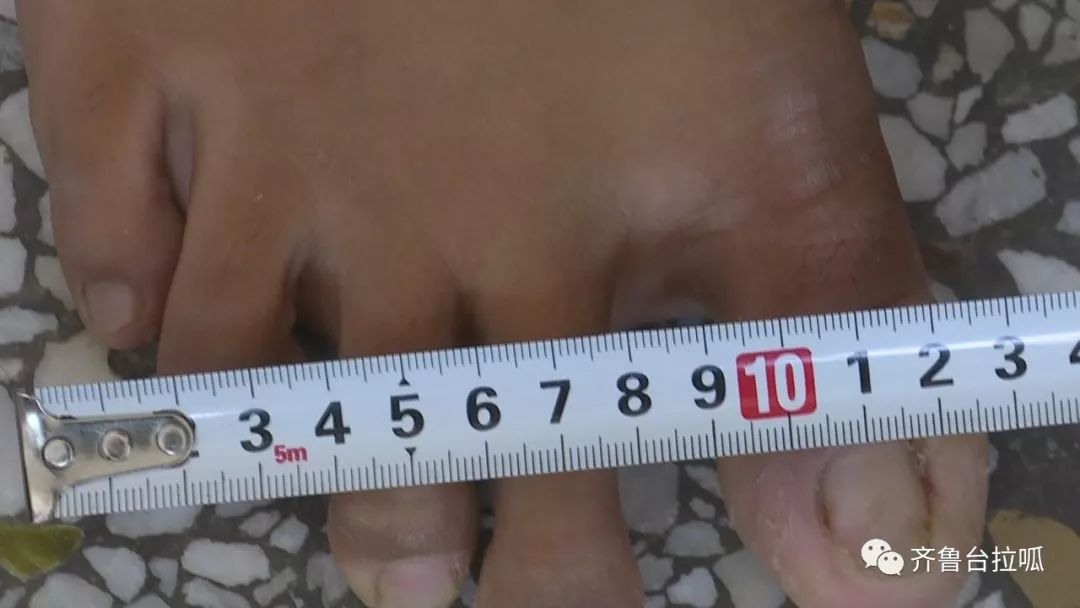 买不到鞋，他打来热线求助，原来脚比姚明都大