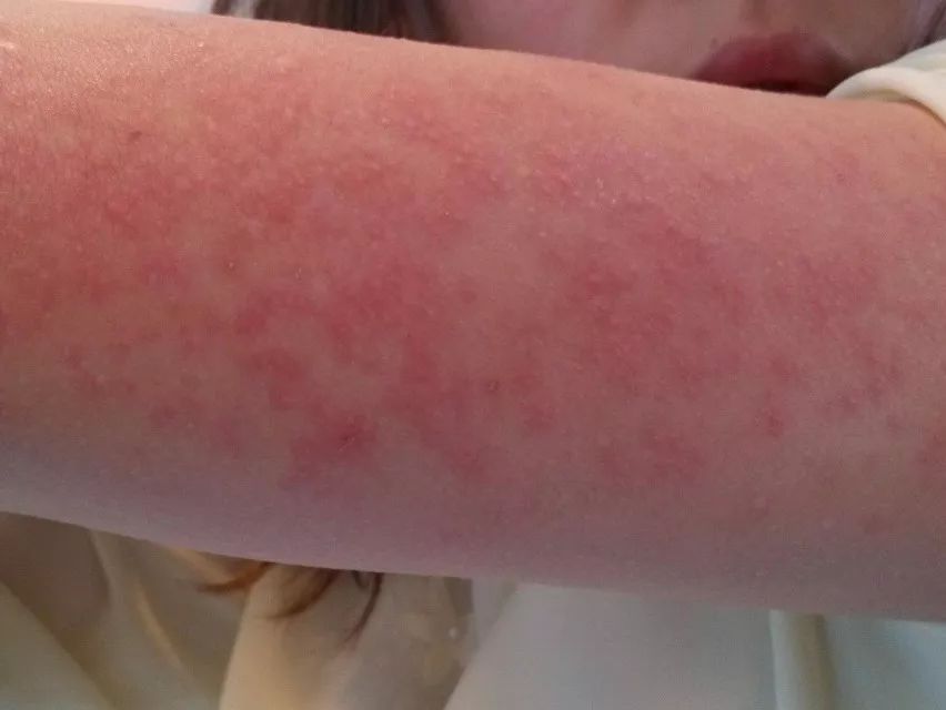 它的菌含量居然是马桶的530倍，你还在每天用