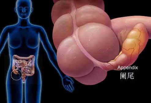 腹腔镜下阑尾炎切除手术记录,阑尾炎腹腔镜手术阑尾怎么缝合