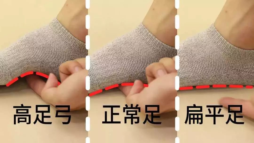 袜子老掉怎么解决,袜子老是脱落有什么办法补救