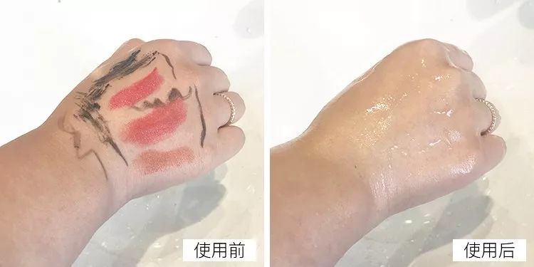 教你1分钟清除99%的脸上螨虫,10秒祛螨虫的药膏