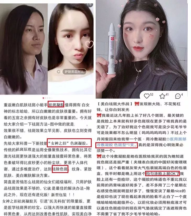 如何改善色斑暗沉问题,面色暗沉色斑多如何改善