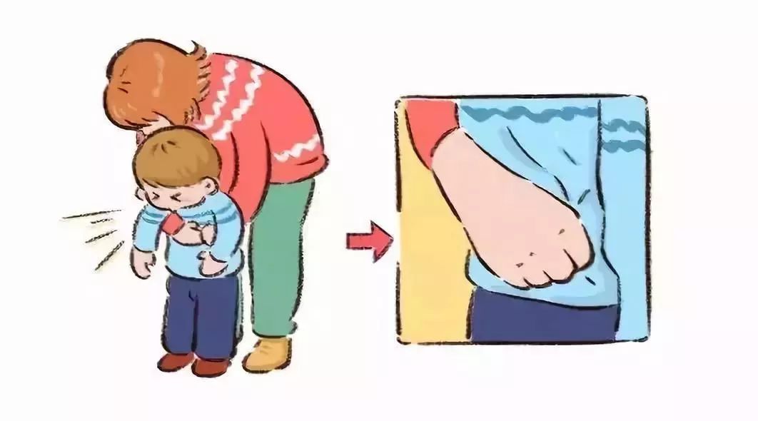 气管卡住异物急救法叫什么,气管异物急救法3-8岁