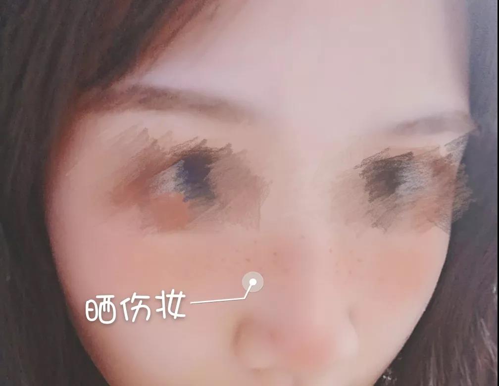 晒伤修复护肤顺序,晒伤妆的正确方法