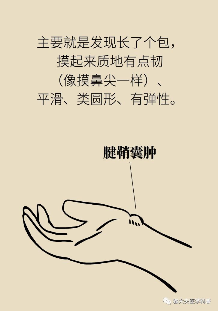 手腕长腱鞘囊肿,小孩手腕起了一个腱鞘囊肿要紧吗