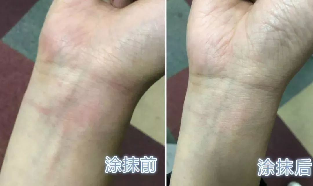 保湿、消炎、止痒、晒后修复,一管芦荟胶全搞定,宝宝也能用