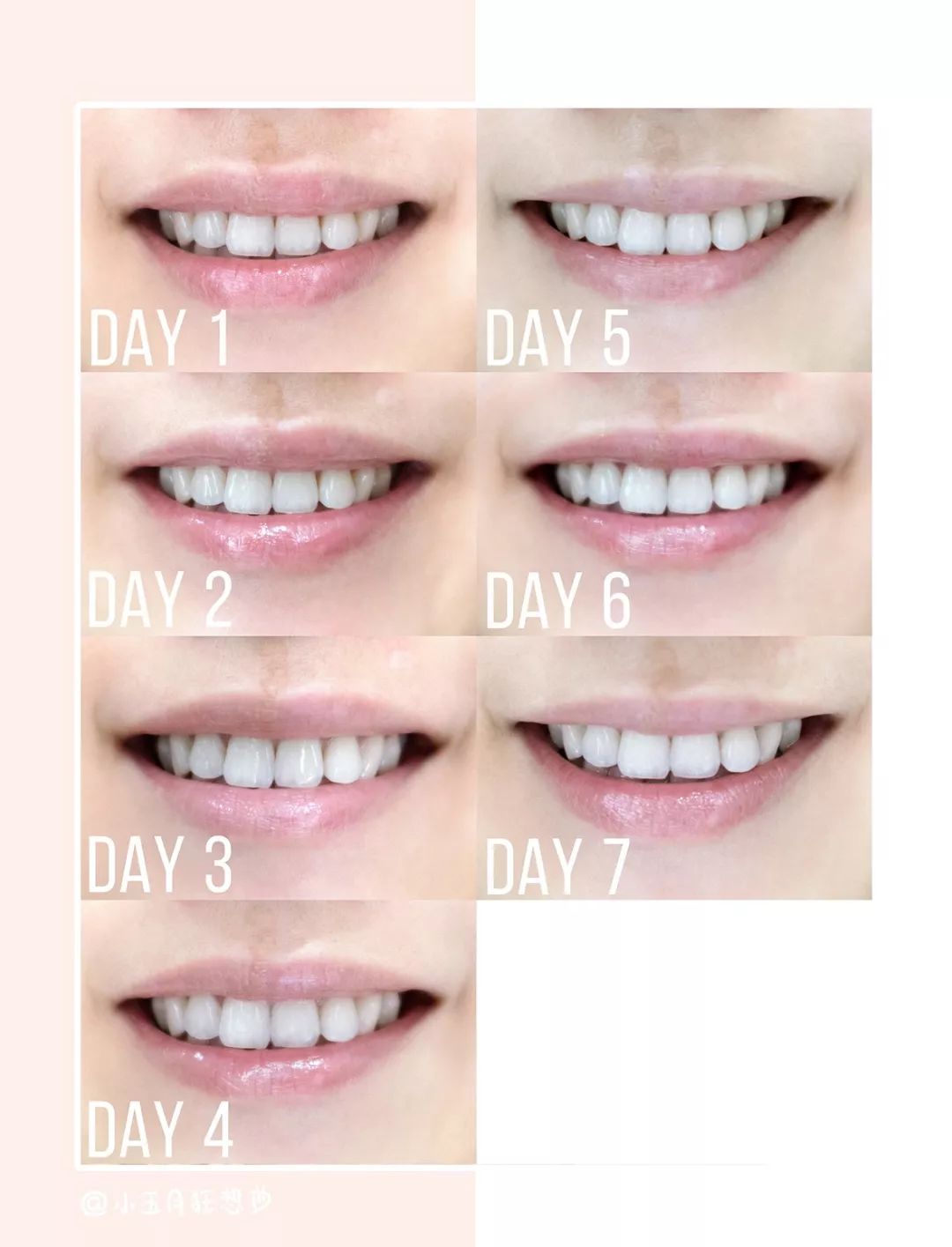 牙齿去黄渍最好的方法,牙齿去渍美白最科学的方法