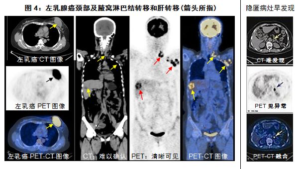 检查癌症最先进的仪器,目前最先进的查癌症的设备是