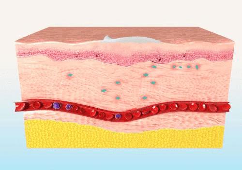 治痔疮最佳的偏方有效的痔疮膏,第一次得痔疮轻微的痔疮膏推荐