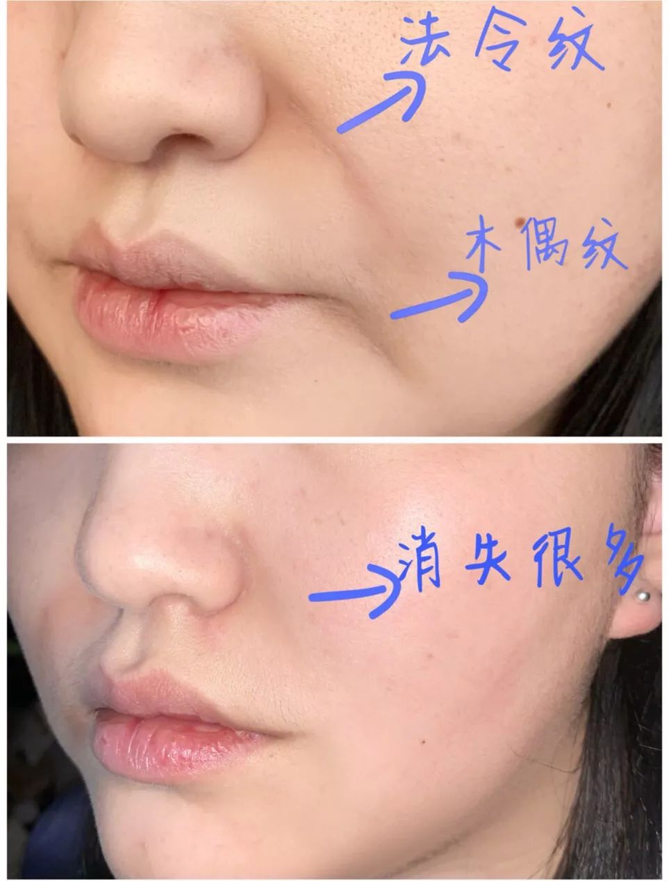 懒人美白黑科技,黑科技一秒变白的神器