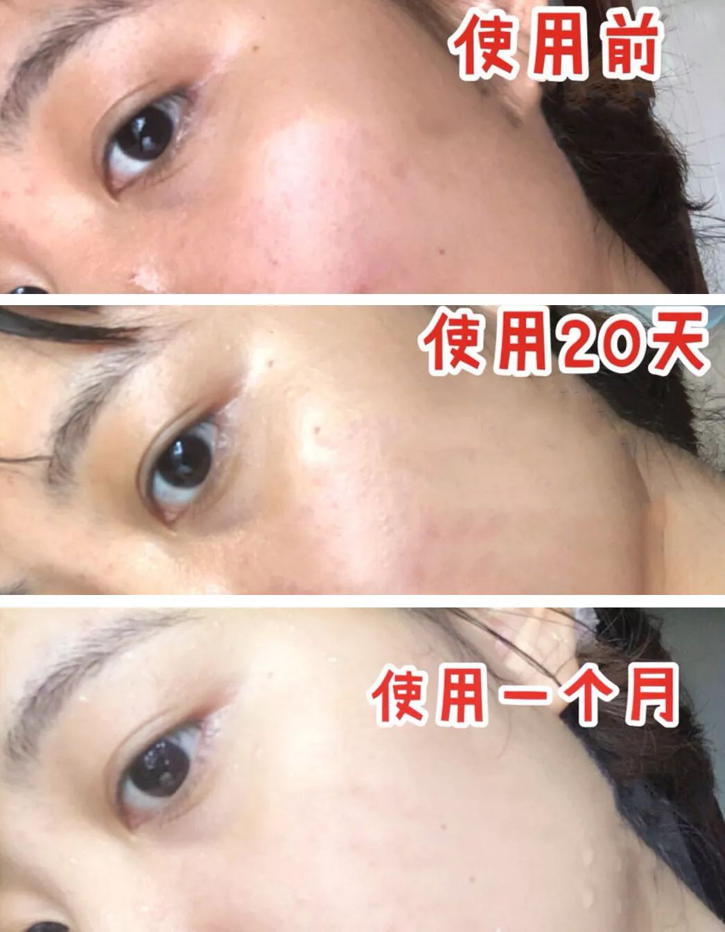 黑科技一秒祛斑,黑科技美白真的有效吗