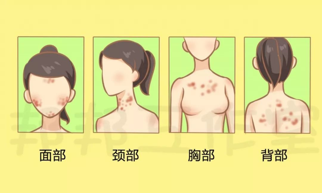 青春期孩子起痘痘应该怎么护理,美容院如何做痘痘肌肤的护理