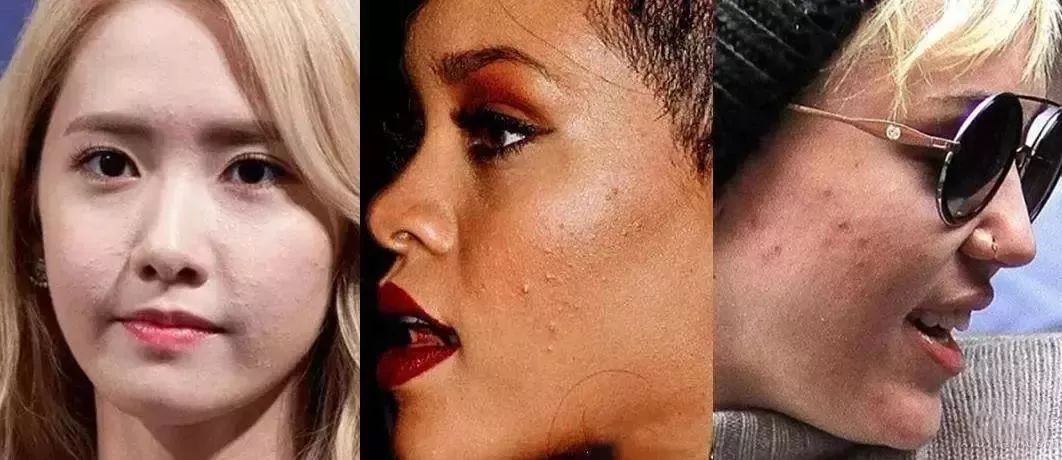 脸上搓下来很多泥,脸上搓出黑头