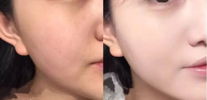 脸上搓下来很多泥,脸上搓出黑头