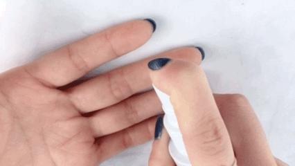 比创可贴好用,最好用的液体创可贴