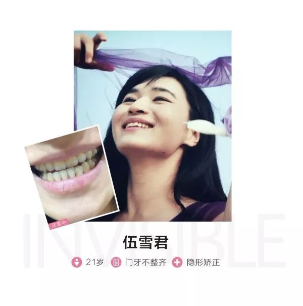 别人矫牙1万起,广州只要3960元!仅限2天