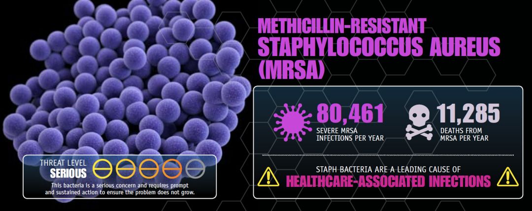 金色葡萄球菌感染会死吗,金色葡萄球菌感染有危险吗