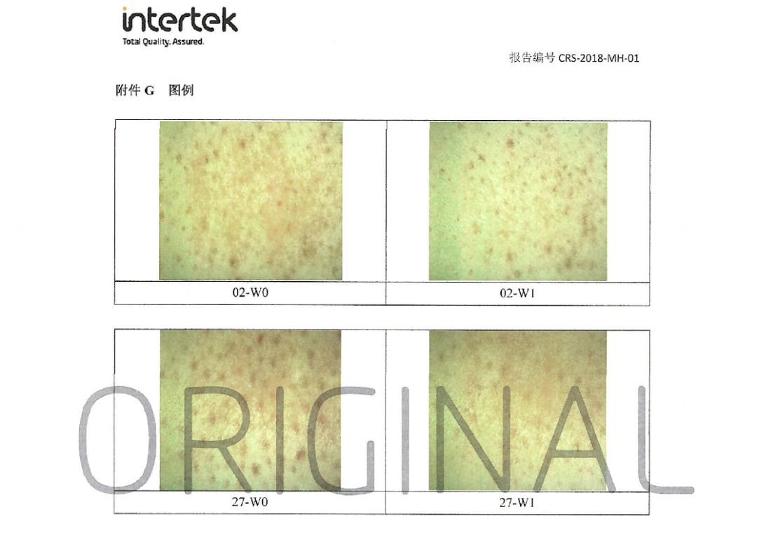 冬天皮肤起皮干燥有碎屑怎么保湿,下巴周围干燥起皮有小疙瘩