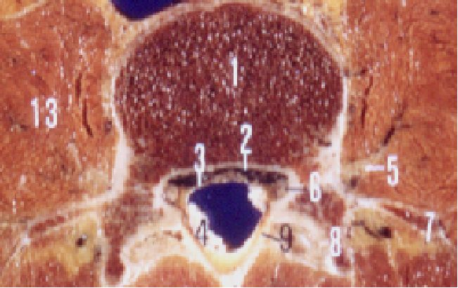 一分钟带你了解腰椎狭窄,椎管狭窄症知识大全