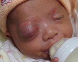 宝宝身上起红点当心这些皮肤病,嘴唇内壁长了个小红点是血管瘤吗