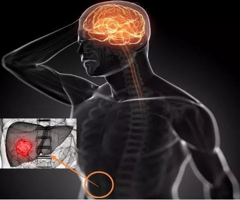 护肝,选择高支链氨基酸饮食