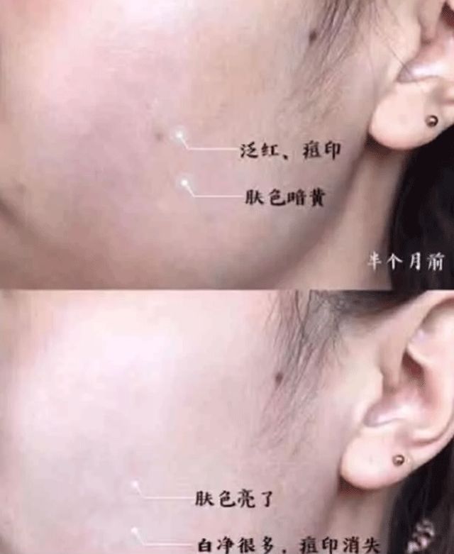 芦荟胶祛痘补水晒后修复,零添加无危害芦荟胶补水推荐