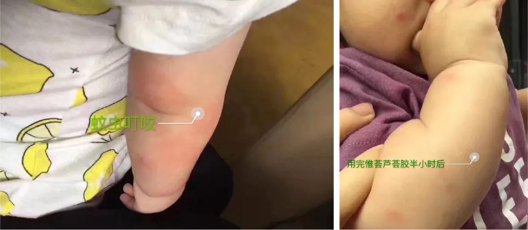 芦荟胶补水保湿提亮肤色晒后修复,万能芦荟胶补水美白修复敏感肌