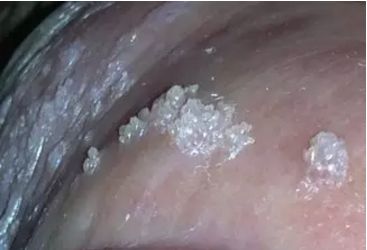 杏林微科普最新消息,杏林微科普帮您认识各类头晕