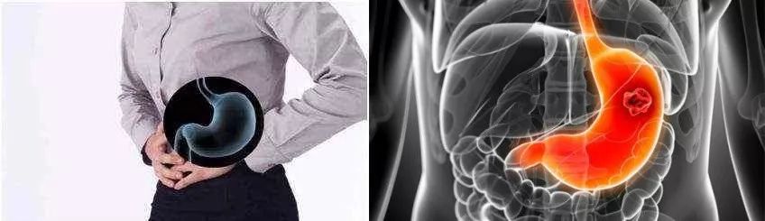 小编推荐丨缓解咳嗽、口臭，试试这个“千金方”！澳洲纯植物提取