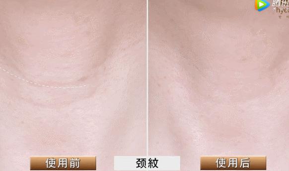 解决皱纹色斑粗糙干燥就用这一套,淡化各种皱纹特别快的好方法