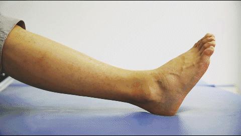 冰敷热敷崴脚,冰敷崴脚后更疼了