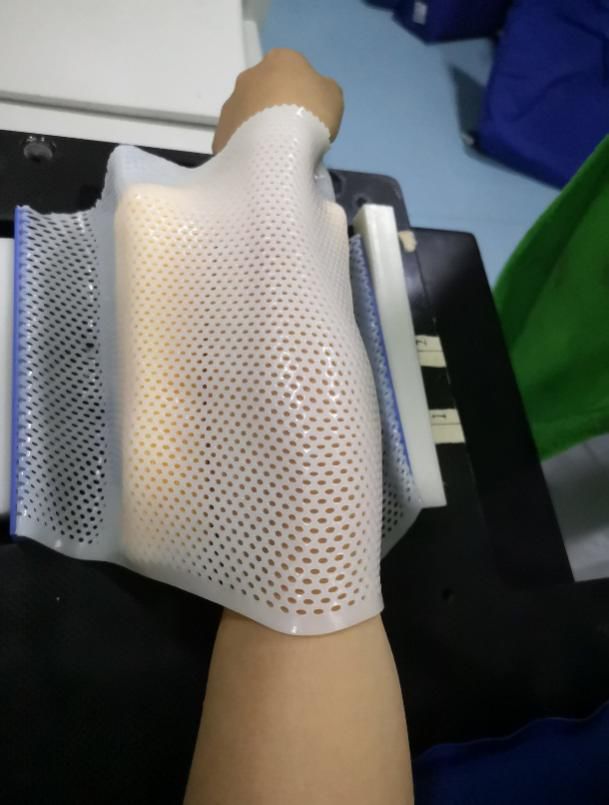 患者初次放疗注意事项,放疗体位固定跟ct模拟需要多久