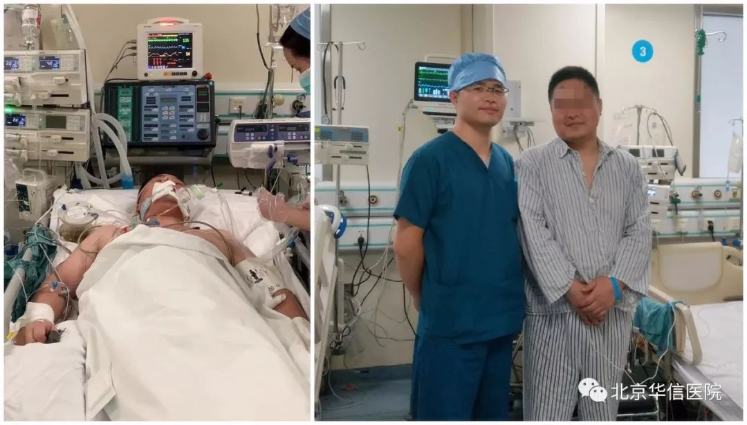 众志成城,“电”后重生——综合ICU成功抢救一位电击伤致心跳骤停患者