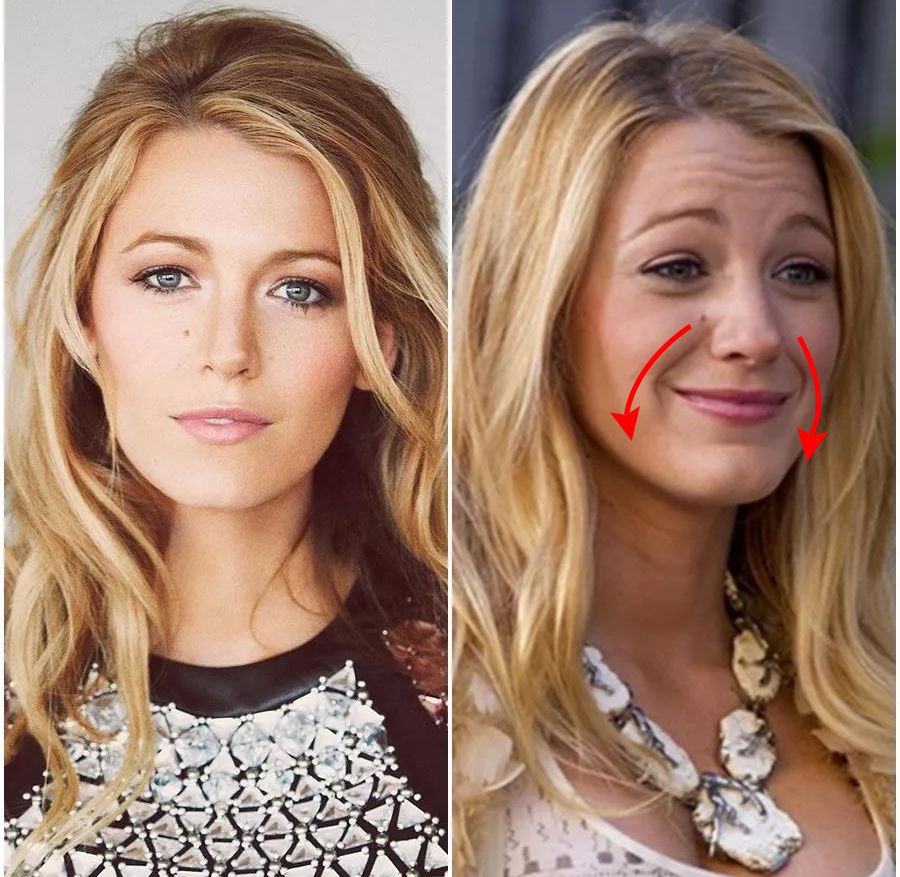 法令纹又黑又长,法令纹又深又长好吗