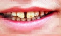 福州市民凭身份证免费牙齿矫正,身份证520开头免票