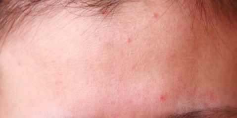 整容明星脸翻车现场,明星整容翻车名场面