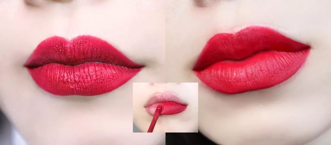 薄唇如何丰唇好看,丰唇使嘴唇变得更美
