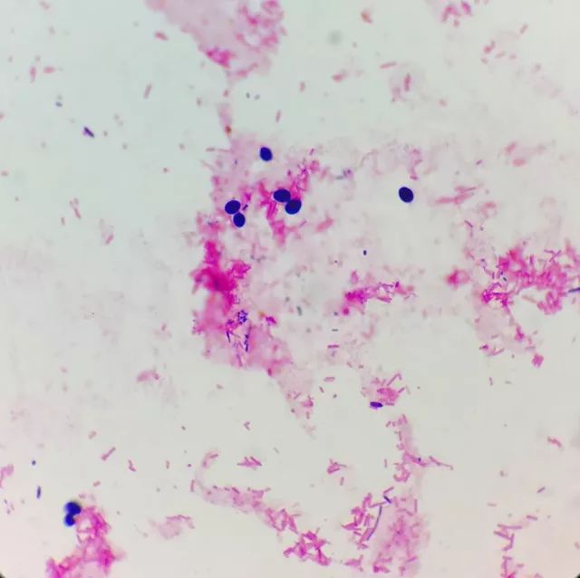 女儿大便里面有霉菌,孩子粪便里有霉菌