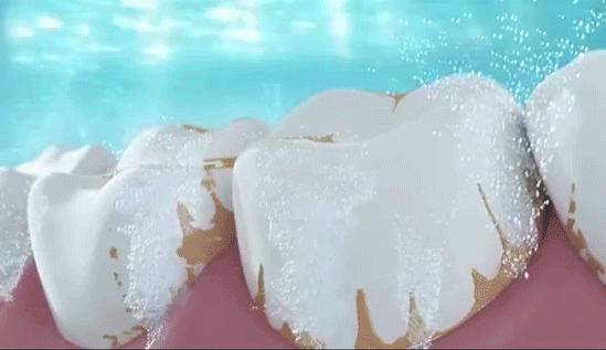 牙龈上火、红肿，还口臭？香港人用了91年的中药牙膏，消炎抑菌，让你刷出一口健康好牙