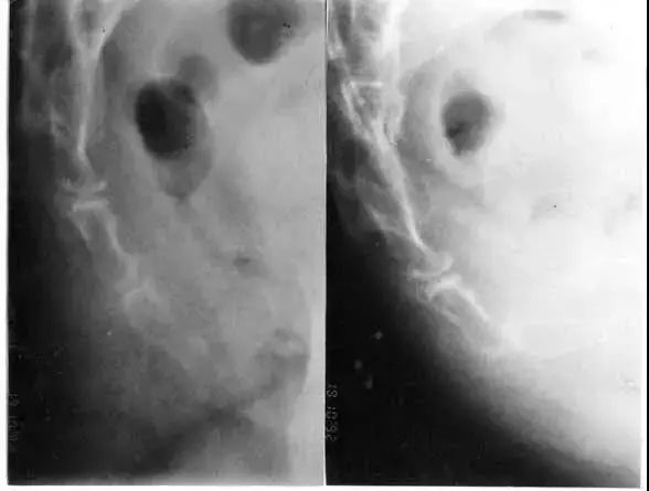 一文读懂十种腹痛,一文读懂骨关节炎