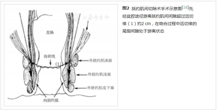 直肠吻合口狭窄内镜下切开术,经肛全直肠系膜切除术哪里可以做