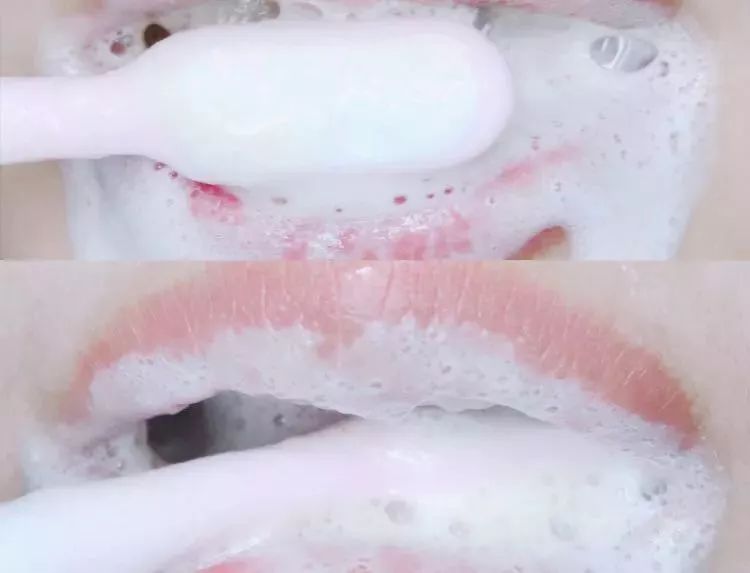 团购|俄罗斯亮白牙膏组合，轻松瓦解多年牙垢，清新口气告别黄牙