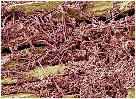 蛀牙真的是虫蛀的嘛,蛀牙是真的有虫吗视频