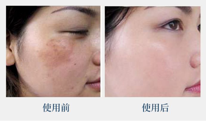 44岁的她竟睡服半个娱乐圈，被亿万直男跪舔！遭小S妒忌十年：凭什么？