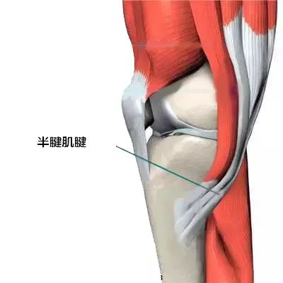 摔了一跤半月板二度撕裂,摔一跤膝盖半月板裂开了