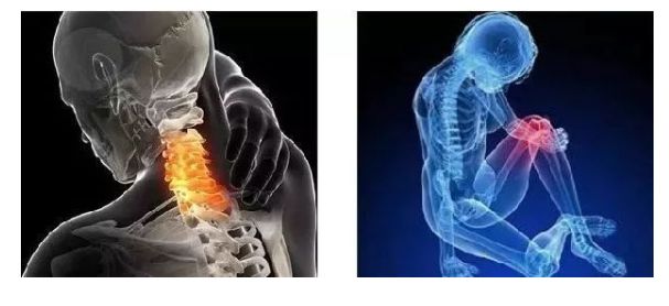 富贵包导致脖子筋痛用什么治疗,富贵包消除的最佳神器